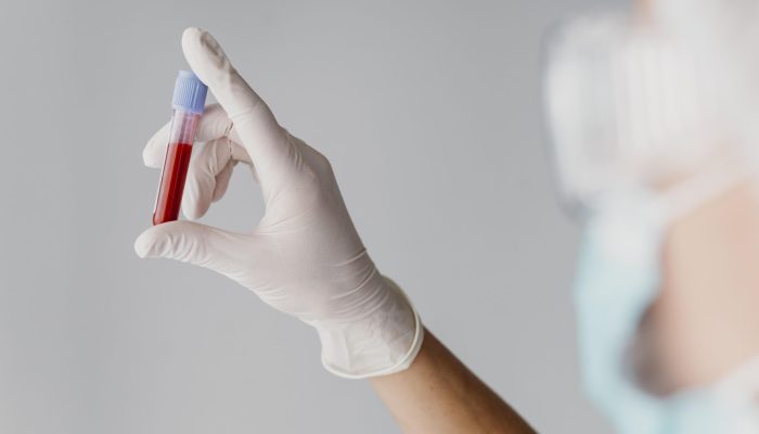 Гематолог Пономарев дал рекомендации, как поднять гемоглобин в крови